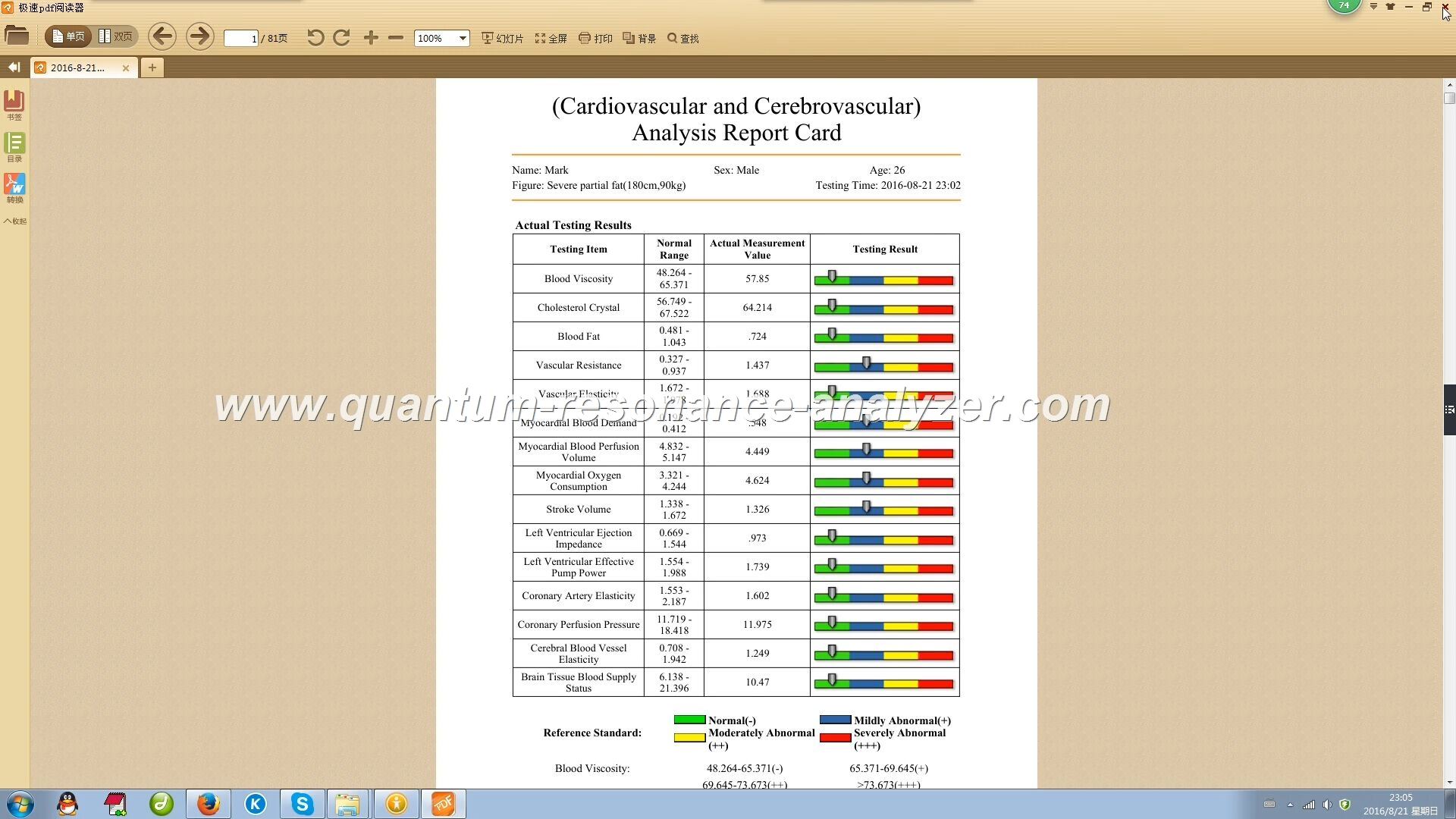 UnderstandingtheWorkingPrincipleofQuantumMagneticResonanceBodyAnalyzerMachine 73 813c